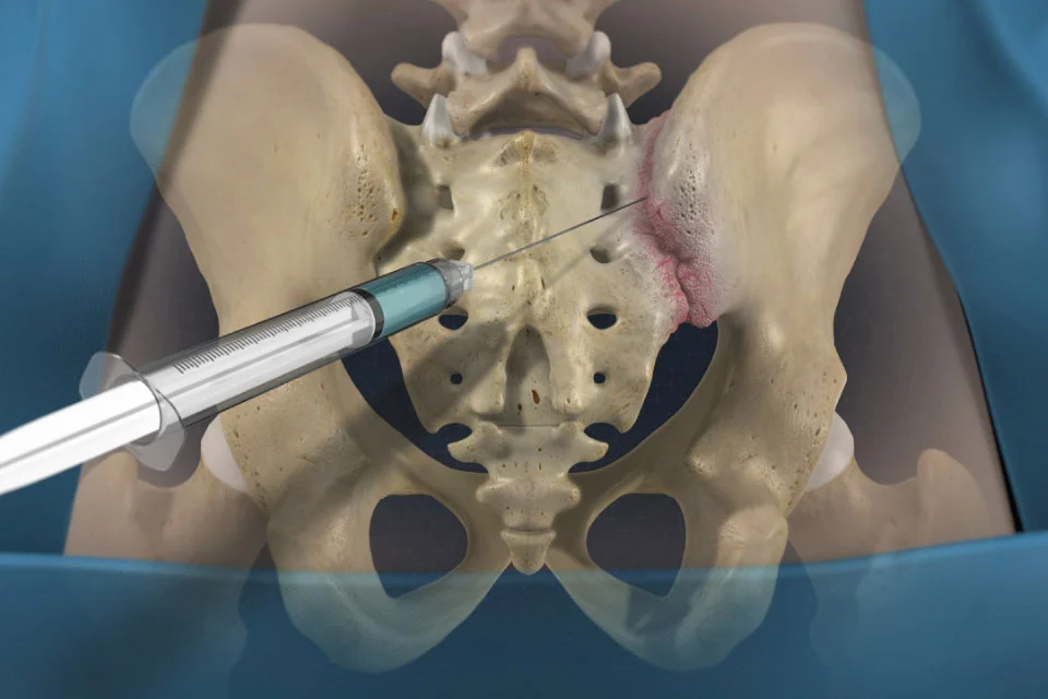 EKLEM İÇİ ENJEKSİYONLAR